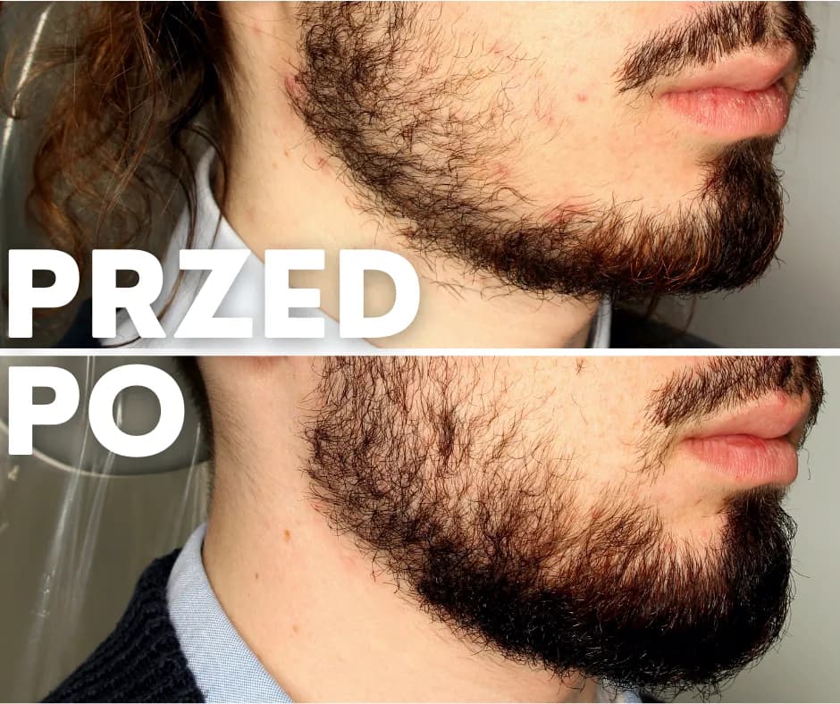 Zapuszczanie zarostu: od zera do brodacza. Poradnik bez błędów