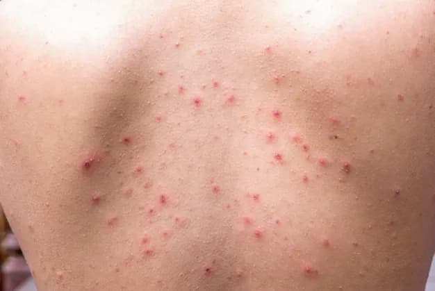 Jak pozbyć się pryszczy na plecach? Kompletny przewodnik po gładkiej skórze