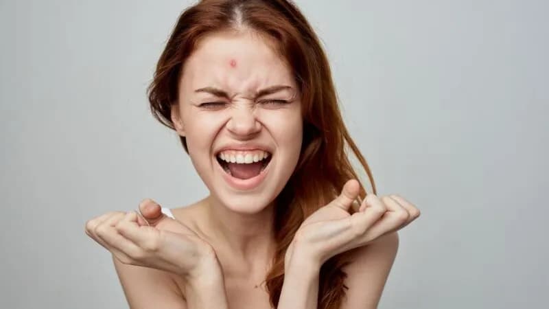 Jak szybko pozbyć się pryszcza? Sprawdzone metody i triki!