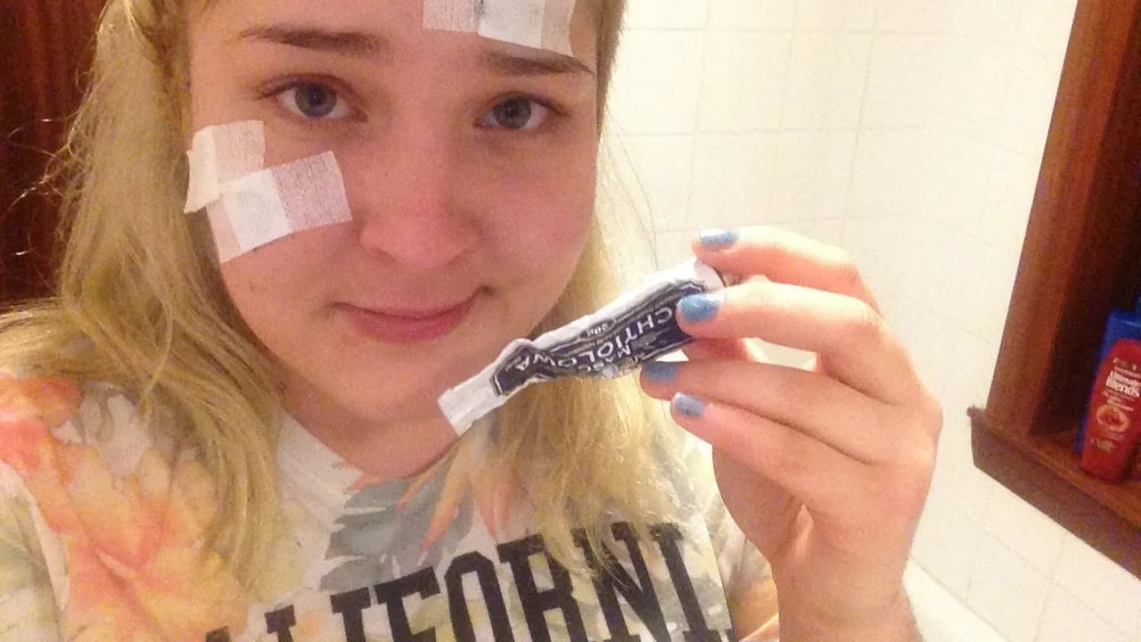 Maść ichtiolowa na pryszcze: Jak bezpiecznie i skutecznie stosować?