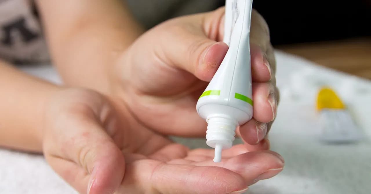 Czy maść cynkowa na pryszcze to Twój ratunek? Sprawdź, jak działa