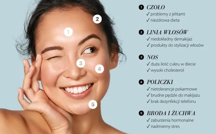 Pryszcze na policzkach: Hormony, dieta, nawyki co naprawdę szkodzi?